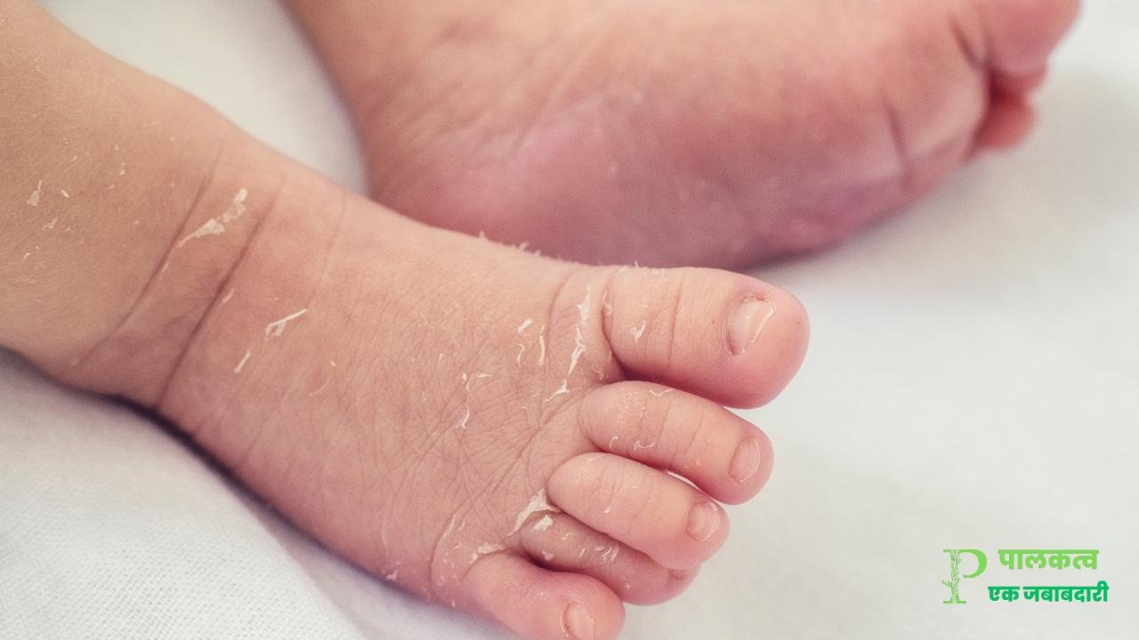 How To Prepare Baby Skin For Winter In Marathi